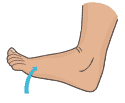 Toe1